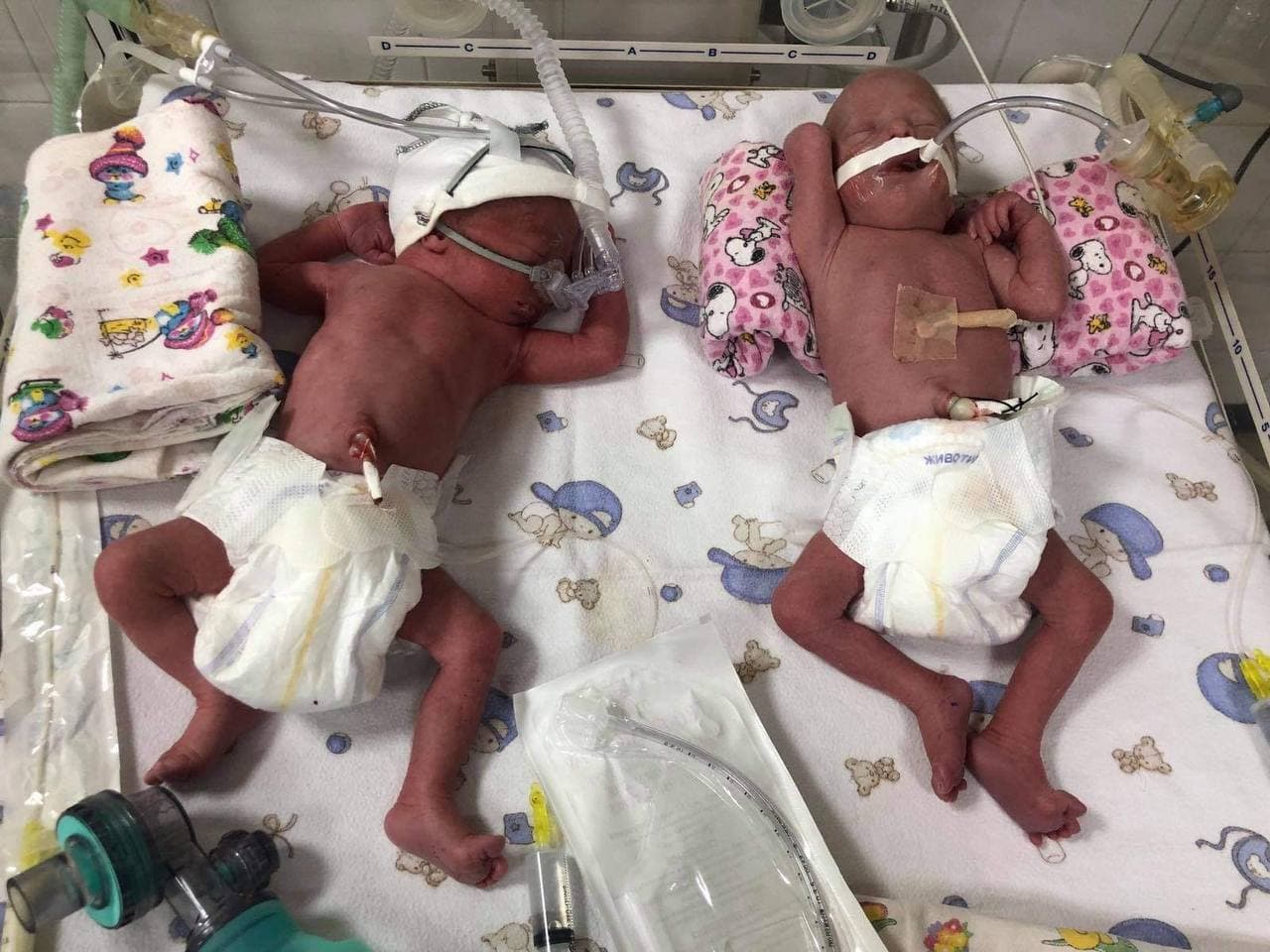 на Закарпатье впервые родилась четверня